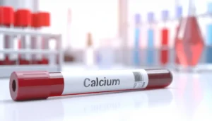 Interprétez les résultats de votre bilan phosphocalcique en quelques clics grâce à votre diététicien